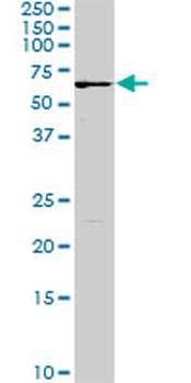 FGR monoclonal antibody (M01), clone 3G10