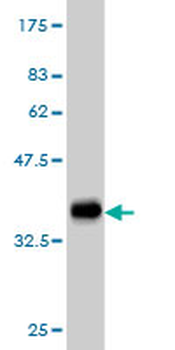 FGR monoclonal antibody (M01), clone 3G10