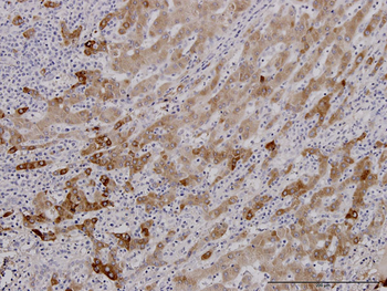 FGG monoclonal antibody (M01J), clone 1F2