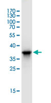 FGG monoclonal antibody (M01J), clone 1F2