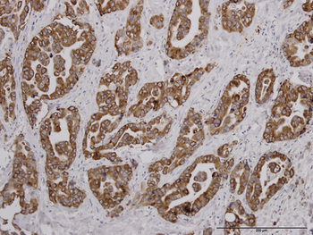 FGFR2 monoclonal antibody (M01J), clone 1G3