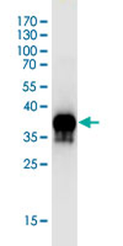 FGFR2 monoclonal antibody (M01J), clone 1G3