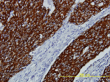 FGFR2 monoclonal antibody (M01), clone 1G3