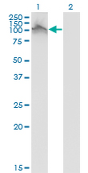 FGFR2 monoclonal antibody (M01), clone 1G3