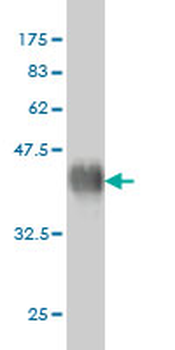 FGFR2 monoclonal antibody (M01), clone 1G3