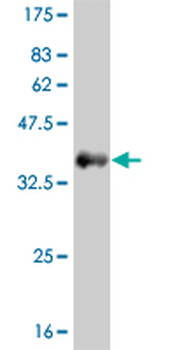 FGFR1 monoclonal antibody (M15), clone 3C9