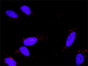FGFR1 monoclonal antibody (M03), clone 5E9