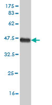 FGFR1 monoclonal antibody (M03), clone 5E9