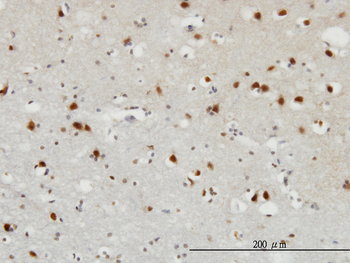 FGF12 monoclonal antibody (M10), clone 1D9