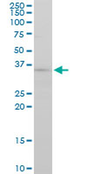 FGF8 monoclonal antibody (M01), clone 2A10