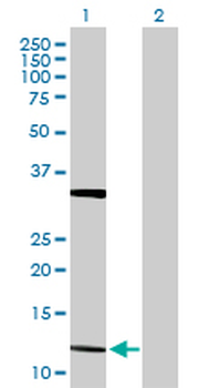 FGF5 purified MaxPab rabbit polyclonal antibody (D01P)