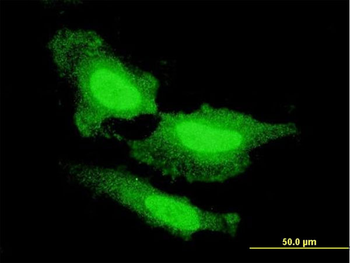 FGF1 monoclonal antibody (M02), clone 2E12