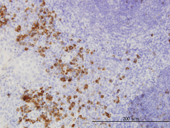 FGF1 monoclonal antibody (M02), clone 2E12
