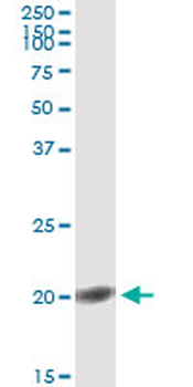 FGF1 monoclonal antibody (M02), clone 2E12