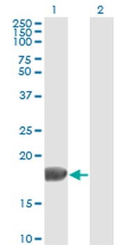 FGF1 monoclonal antibody (M02), clone 2E12