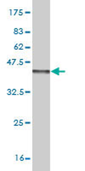 FGF1 monoclonal antibody (M02), clone 2E12