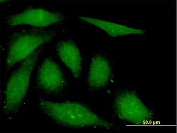 FGF1 monoclonal antibody (M01), clone 3F5