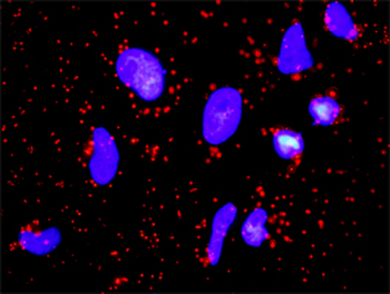 FGF1 monoclonal antibody (M01), clone 3F5
