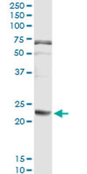 FGA monoclonal antibody (M01), clone 1D12