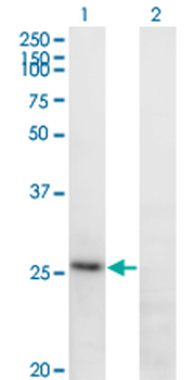 FGA monoclonal antibody (M01), clone 1D12