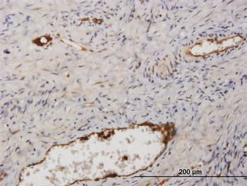 FGA purified MaxPab rabbit polyclonal antibody (D01P)