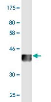 FDX1 monoclonal antibody (M02), clone 4G5