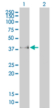 FCGR2B monoclonal antibody (M01A), clone 2E10