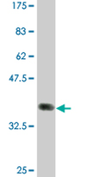 FCGR2B monoclonal antibody (M01A), clone 2E10