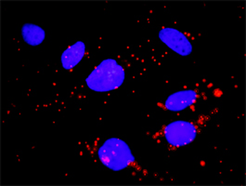 FCGR1A monoclonal antibody (M01), clone 1D3
