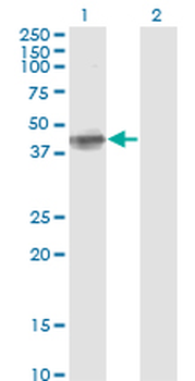 FCER2 monoclonal antibody (M04A), clone S51