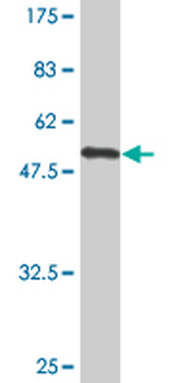 FCER2 monoclonal antibody (M04A), clone S51