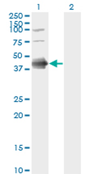 FCER2 monoclonal antibody (M03), clone S52