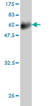FCER2 monoclonal antibody (M03), clone S52