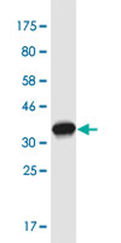 FBN2 monoclonal antibody (M01), clone 1C2