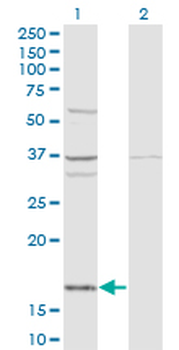 FAU monoclonal antibody (M03), clone 3C10