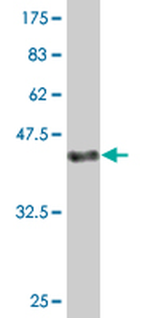 FAU monoclonal antibody (M03), clone 3C10