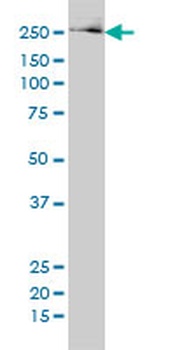 FASN monoclonal antibody (M01), clone 3F2-1F3