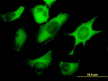 FASN monoclonal antibody (M01), clone 3F2-1F3
