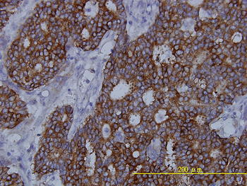 FASN monoclonal antibody (M01), clone 3F2-1F3