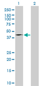 FASN monoclonal antibody (M01), clone 3F2-1F3