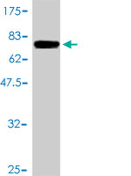 FASN monoclonal antibody (M01), clone 3F2-1F3