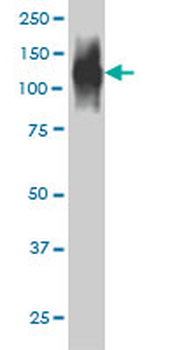 FAP monoclonal antibody (M01), clone 1E5