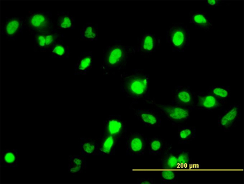 FANCG monoclonal antibody (M01), clone 2C8