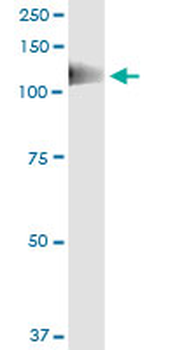 PTK2B monoclonal antibody (M01), clone 1F9