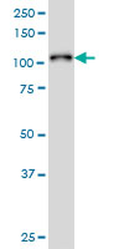 PTK2B monoclonal antibody (M01), clone 1F9