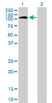 PTK2B monoclonal antibody (M01), clone 1F9