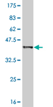 PTK2B monoclonal antibody (M01), clone 1F9
