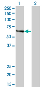 FANCC monoclonal antibody (M01), clone 6E7