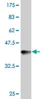FANCC monoclonal antibody (M01), clone 6E7