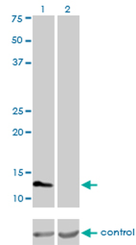 FABP3 monoclonal antibody (M01), clone 4F6-1D6
